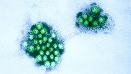 Eine elektronenmikroskopische Aufnahme vom Norovirus