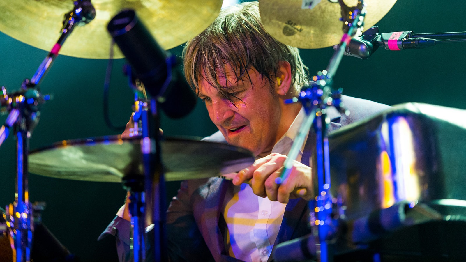 Triggerfinger