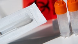 Ein Wattestäbchen und zwei Röhrchen für biologische Proben von einem DNA-Test zur Ahnenforschung stehen auf einem Tisch.