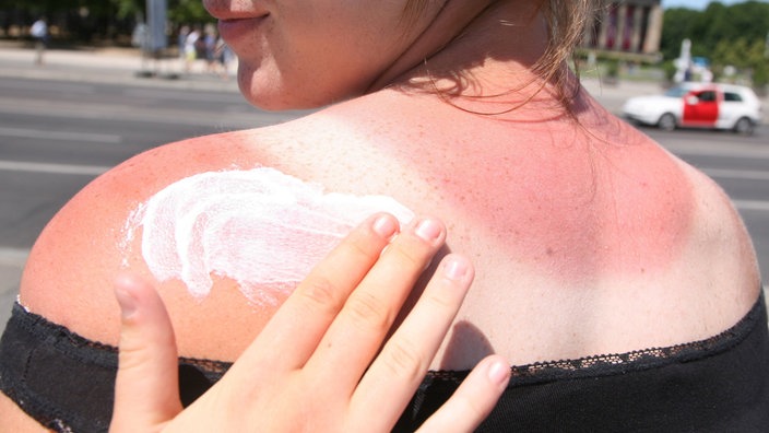 Eine Frau bekommt den Rücken mit Sonnencreme eingecremt 