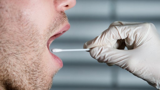DNA-Analyse
