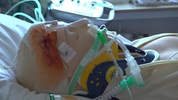 Eine Puppe liegt mit Verbänden und Schläuchen um das Gesicht und Mund auf einem Krankenbett
