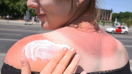Eine Frau bekommt den Rücken mit Sonnencreme eingecremt