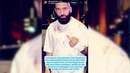 Die Insta-Story von Sinan-G zeigt ihn mit Mittelfinger ausgestreckt, Blut auf dem Shirt und einer dankbaren Botschaft über sein Überleben.