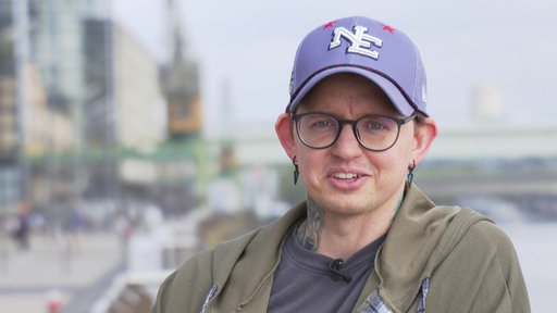 Nahaufnahme von Billie mit einer lilanen Baseballcap.
