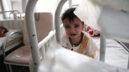 Ein weinendes Kind, das wegen Unterernährung im Indira-Gandhi-Institut für Kindergesundheit behandelt wird (13.07.2016).
