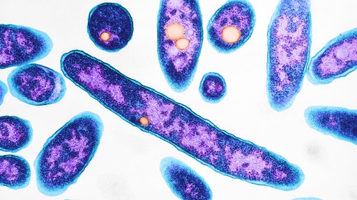 Legionnaires disease bacteria