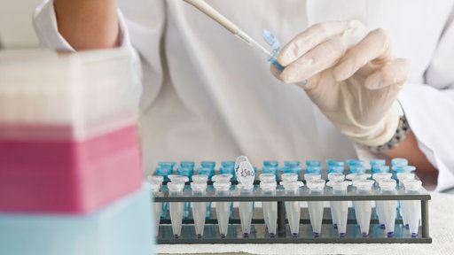 Ein Forscher entnimmt mit einer Pipette eine Flüssigkeit aus Reagenzgläsern.